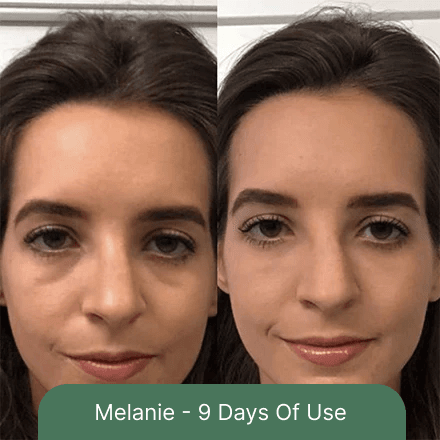 Melanie - 9 Days Of Use